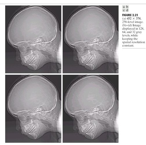 Quantization artefacts — skull at 8-bit vs fewer bits, false contours appear